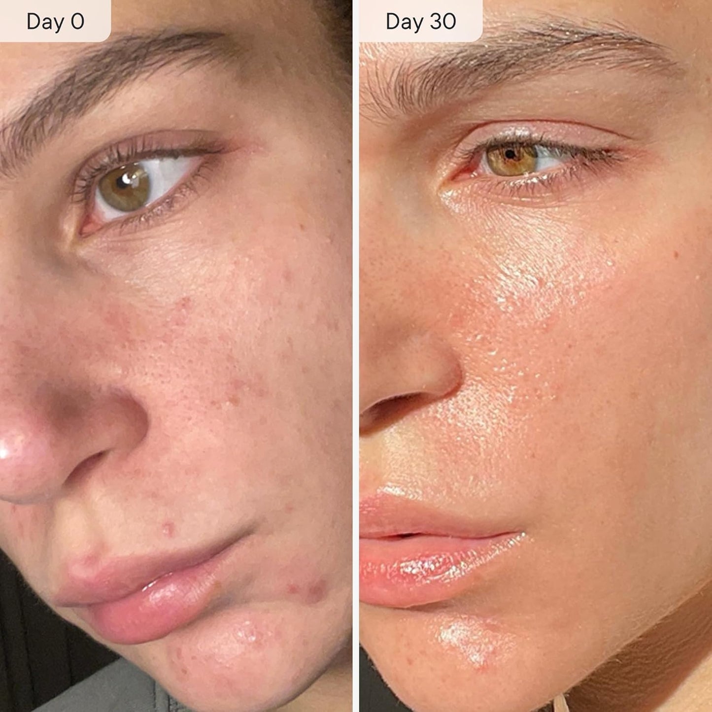 Face & Neck - Facial Moisturizing Essence