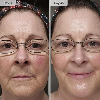 Face & Neck - Facial Moisturizing Essence